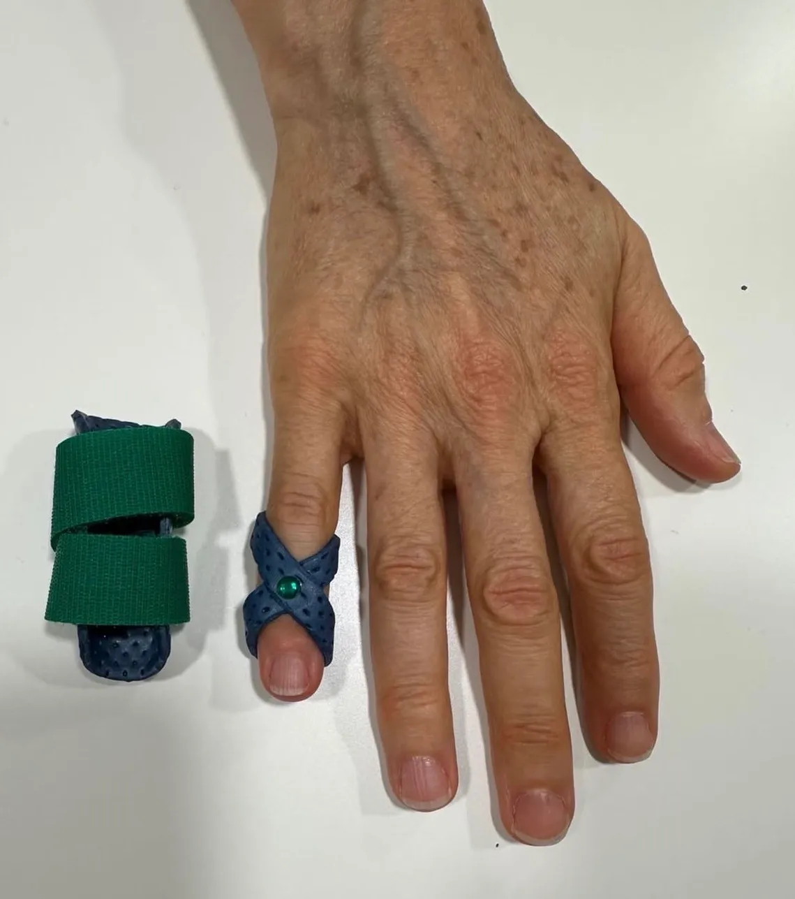 Duas pequenas ortóteses de dedo, uma delas colocada num dedo